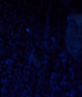 I_Know_Who_Killed_Me_2007_1080p_Bluray_LLP_006878.jpg