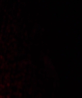 I_Know_Who_Killed_Me_2007_1080p_Bluray_LLP_006882.jpg