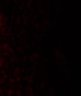 I_Know_Who_Killed_Me_2007_1080p_Bluray_LLP_006887.jpg