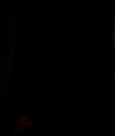 I_Know_Who_Killed_Me_2007_1080p_Bluray_LLP_012709.jpg
